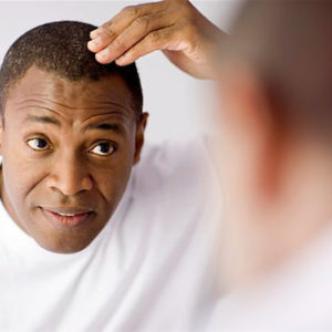 3 Solutions For Balding Men
