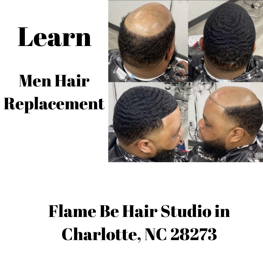 Learn Men Hair Replacement